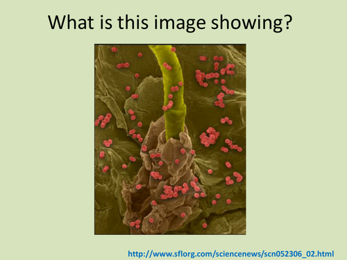 GCSE Core Science - Biology: Microbes and Disease - Lesson 2 - Defences outside the body.