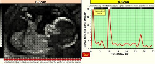 Ultrasound Interactive Spreadsheet