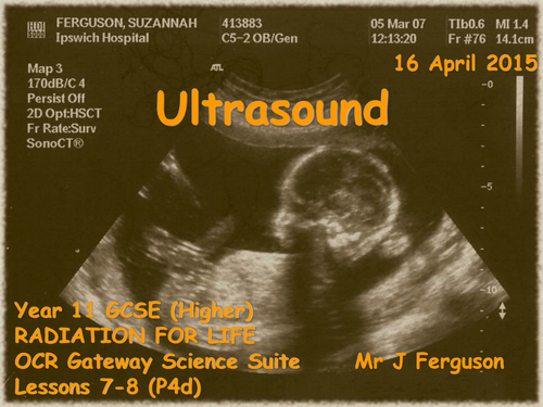 P4d Ultrasound