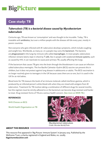 Tb case study picture