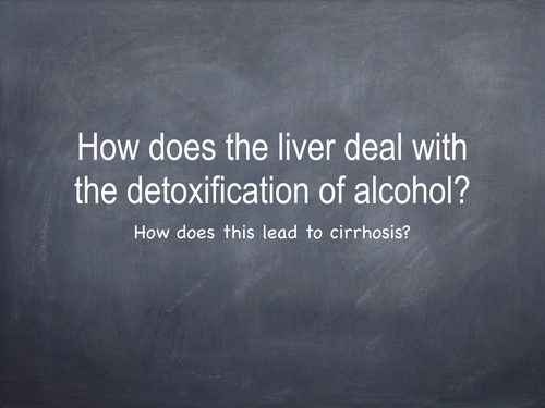 Cirrhosis presentation