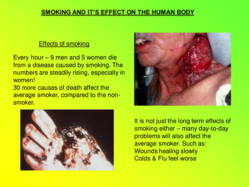 KS3/4 Smoking Powerpoint Presentation