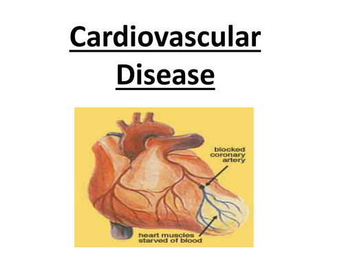 AS Biology - Cardiovacular Disease ppt