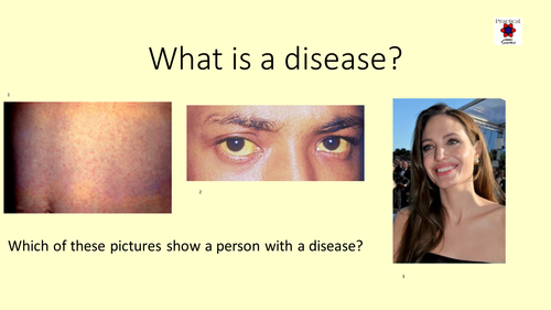 Health and Disease Resources GCSE2016