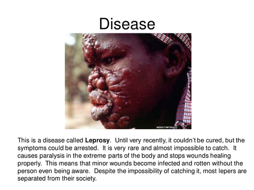 Pathological Disease GCSE Biology