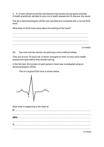 ECGs and the cardiac cycle | Teaching Resources