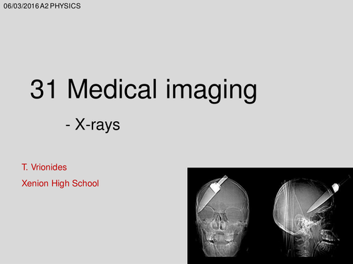 A Level Physics X rays