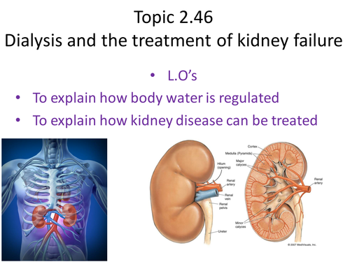 Dialysis and kidney failure