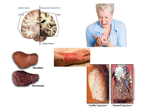 Stem cells and cell division revision resource with differentiated quiz 