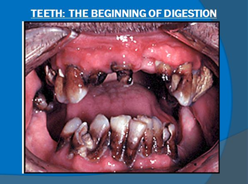 Digestive System Notes-Teeth the Beginning of Digestion Powerpoint Presentation