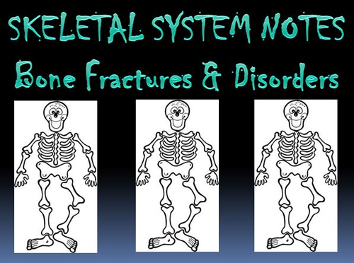 Skeletal System Notes Bone Fractures & Disorders Powerpoint Presentation