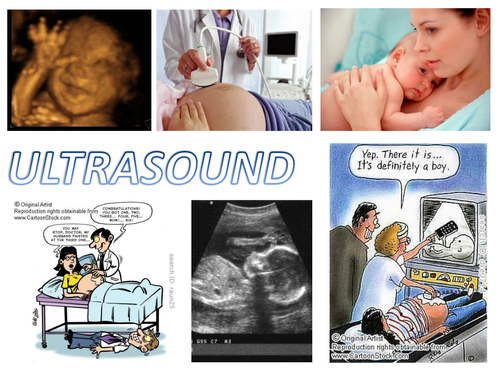 A Level Medical Physics Ultrasound