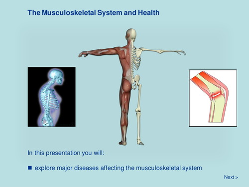 The Musculoskeletal System and Health | Teaching Resources