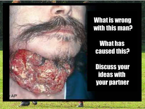 Healthy Lifestyles Smoking