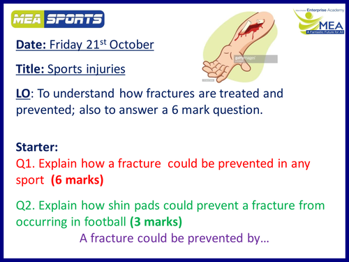 Sports injuries - fractures
