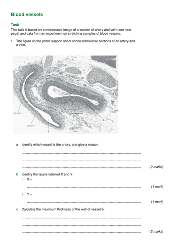 KS4 AQA New 2016 B4 Organising plants and animals L2 Blood vessels