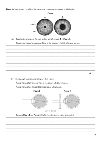 SOLO taxonomy - The eye