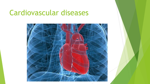 AS Level Biology: Cardio Vascular Diseases
