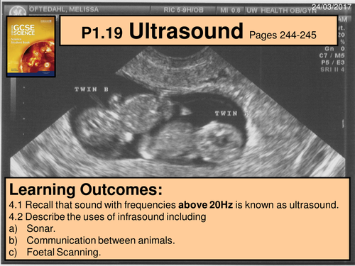 Year 9 - a digital version of the Edexcel P1.19 Ultrasound lesson