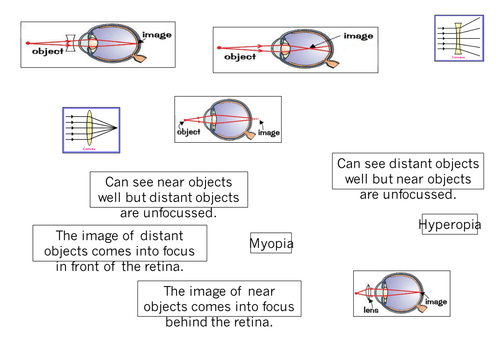 AQA GCSE Biology 9-1 (2016) The Eye