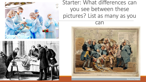 Antiseptic Surgery to Aseptic Surgery