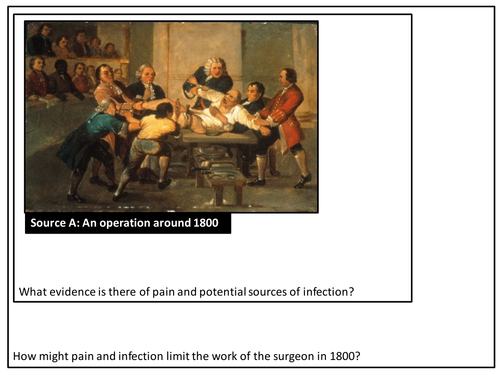 Anesthetics - Pain Relief