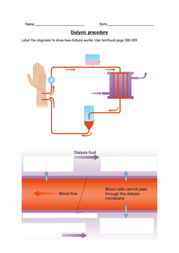 AQA new specification-Dialysis worksheet-B12.4