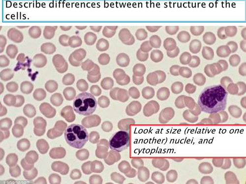 NEW Spec -A level Biology - OCR - Module 4 - chapter 10 - disease - phagocytes and blood smears