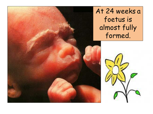 Abortion, Christian Ethics