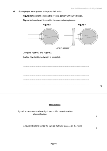 Common problems of the eye