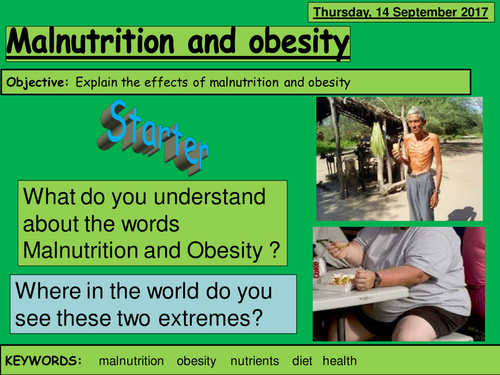 GCSE lesson on Malnutrition