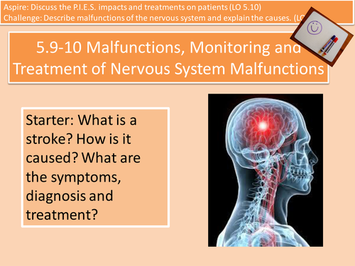 5.9-10 (1 of 5) Brain Malfunctions, Monitoring and Treatment Unit 4 Cambridge Technical Health