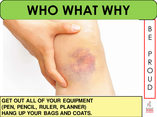 Blood Vessels Lesson