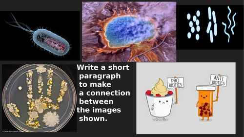 A-Level Topic 2.2.1: Prokaryotic Cells (2 lessons)