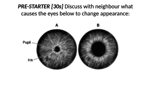 2018 AQA GCSE Biology Unit 2 (B2): Eye Biology L5