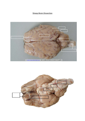 Sheep Brain Dissection