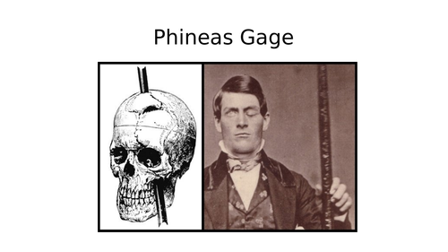 Psychology - Phineas Gage Research Task - Lobes of the Brain