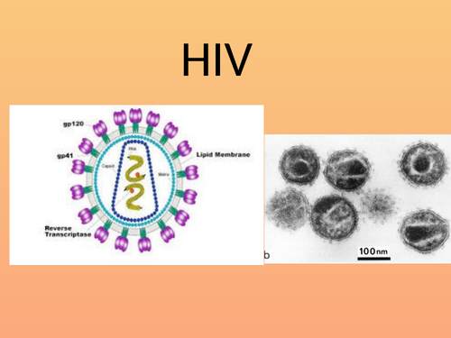 HIV