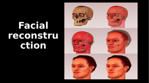 Forensic- facial reconstruction