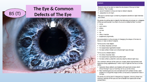 AQA GCSE 9-1 The Eye and Problems/Defects of the Eye (2-3 lessons)