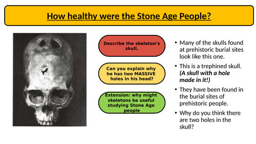 Stone Age Lesssons year 7- medicine x 3