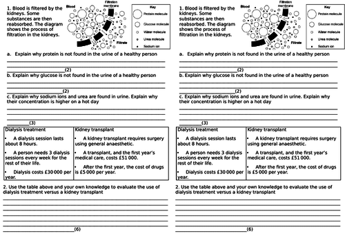 AQA GCSE Kidney disease and treatments