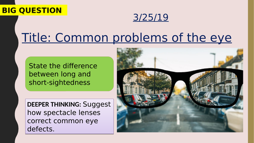 AQA new specification-Common problems of the eye-B10.6