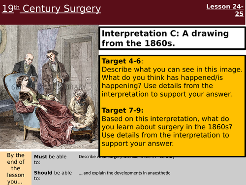 19th Century Surgery