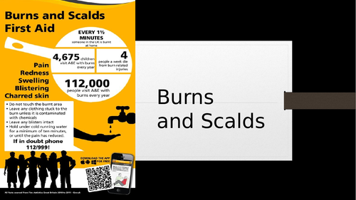 *FIRST AID* Burns and Scalds