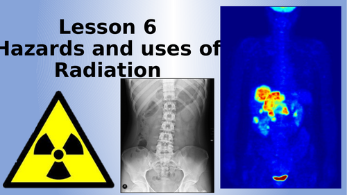 AQA Physics Hazards of Radiation Lesson