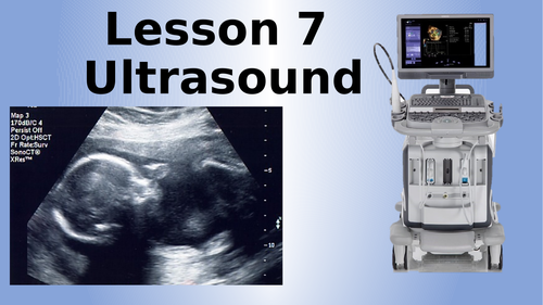 AQA Physics Ultrasound Lesson