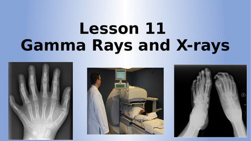 AQA Physics Gamma Rays and X-Rays Lesson