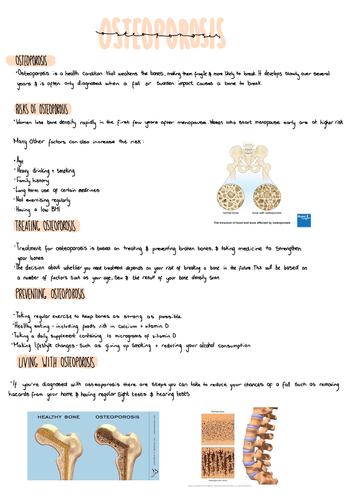 Health and social care, Osteoporosis Fact sheet