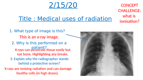 uses of radioactivity in medicine